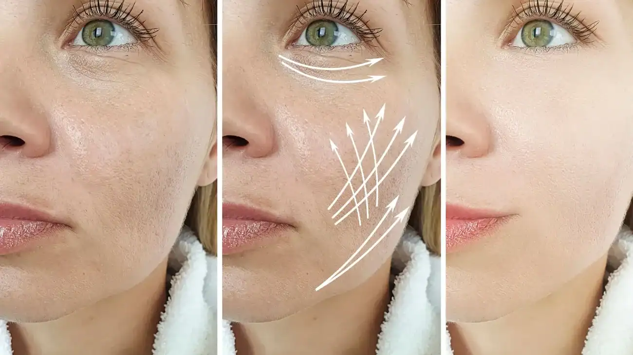 Can One Treatment Really Tackle More Than One Skin Concern Milngavie?