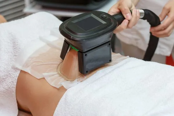 Image of person having fat freezing treatment to help weight gain Milngavie