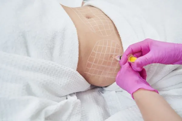 image of fat dissolving injections on love handles to help combat weight gain Milngavie
