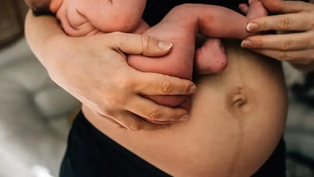 Why Is My Stomach Still Big After Pregnancy Milngavie?